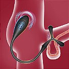 Estimulador de Próstata com Anel Peniano Via Aplicativo